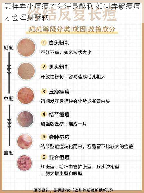 怎样弄小痘痘才会浑身酥软 如何弄破痘痘才会浑身酥软